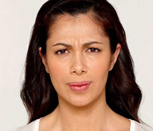 BOTOX® Cosmetic - Actual Patient Results - Before - 2